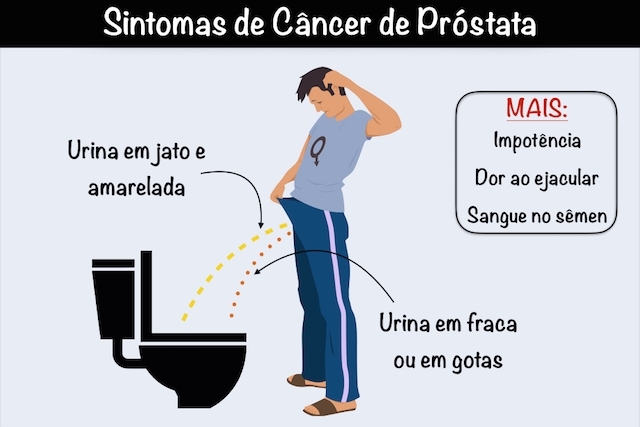 sintomas-de-cancer-de-prostata